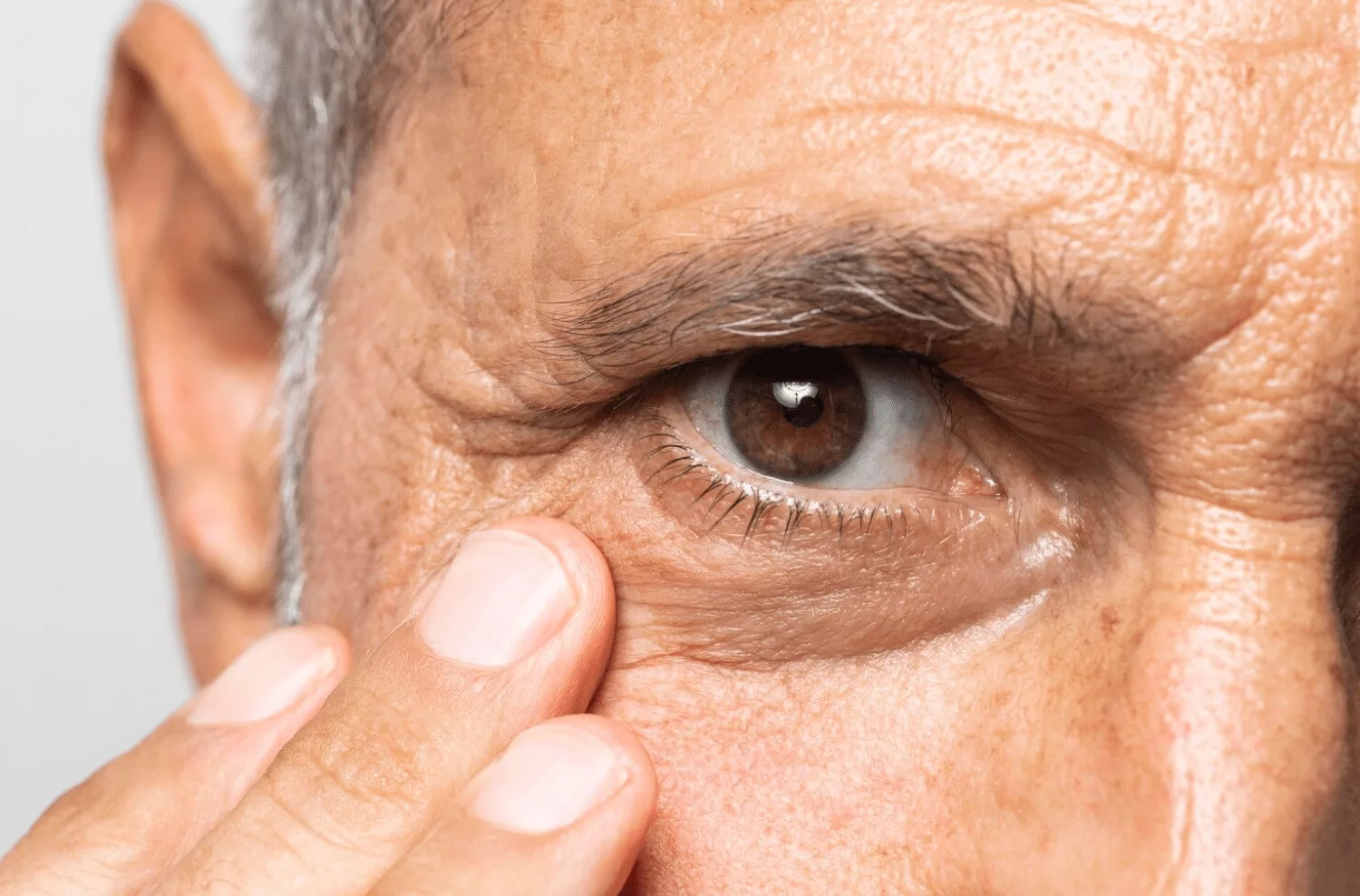 ¿Qué es bueno para eliminar las cataratas de los ojos?